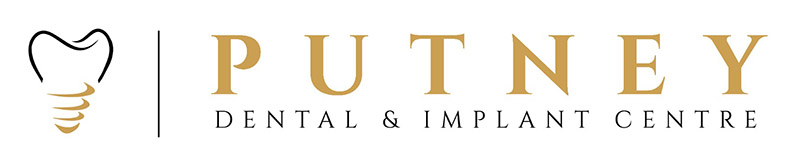 Putney Dental & Implant Centre
